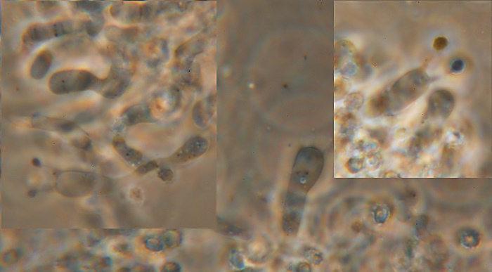 Labile crosticina bianca - foto 3259 (Trechispora farinacea)